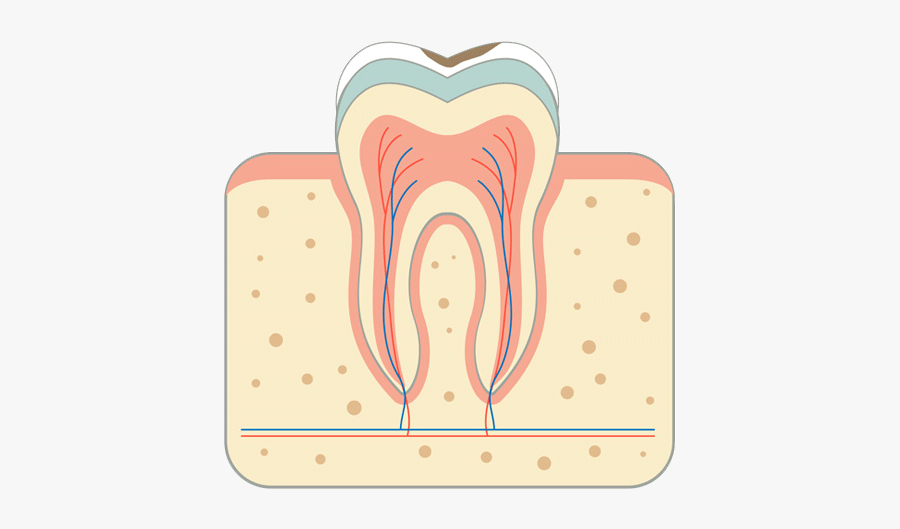 Root Canal South Croydon - Illustration, Transparent Clipart