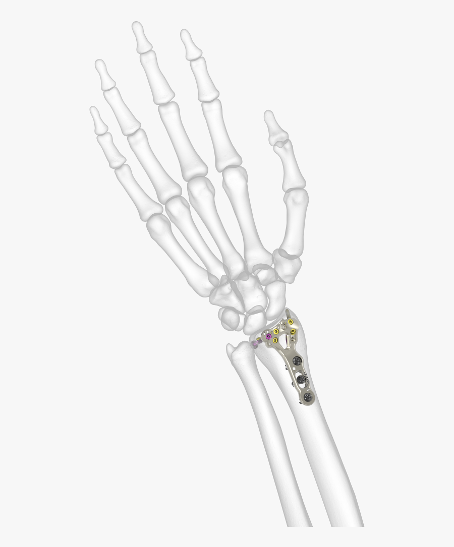 Transparent Bone Radius , Free Transparent Clipart ClipartKey