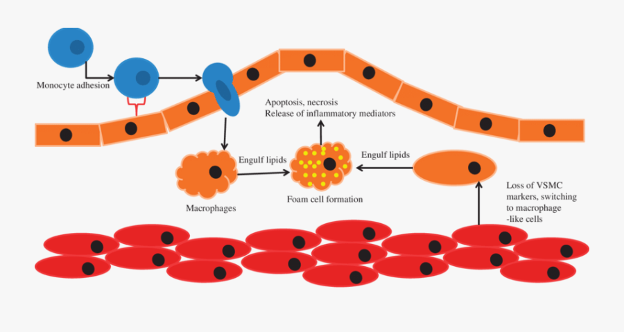 Plaque Clipart Transparent - Atherosclerosis Foam Cell Plaque, Transparent Clipart