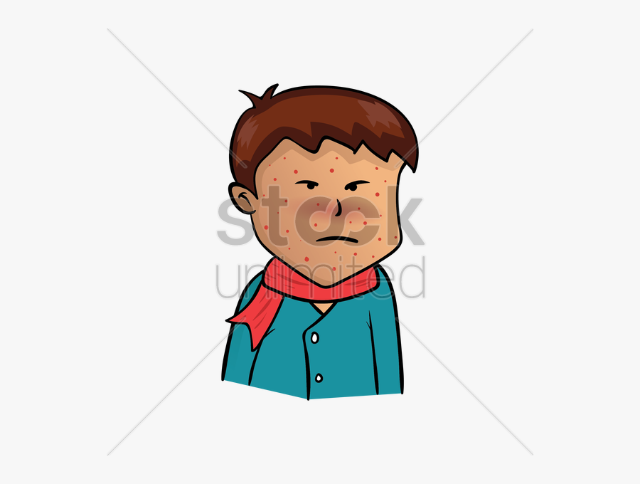 Pox Group Boy Having - Vector Graphics, Transparent Clipart