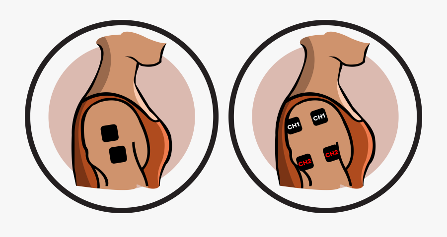 Shoulder Electrode Pad Placement - Tens Pads Placement Shoulder, Transparent Clipart