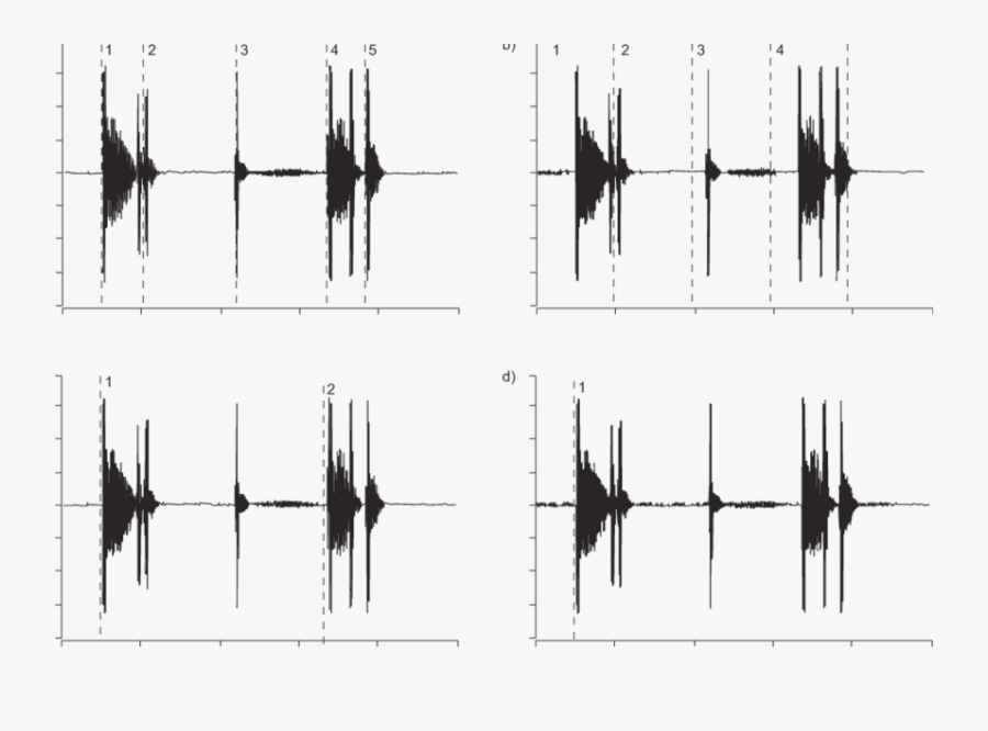 Various Methods Of Quantifying Coughing: A) Explosive - Reflection, Transparent Clipart