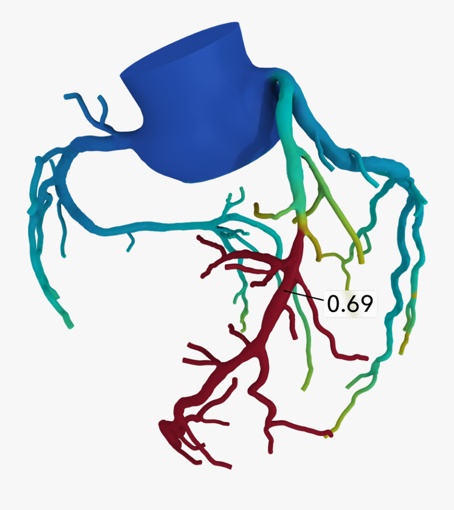 Arielle Crandall, Bsn, Rn Liked This - Cta Coronary Arteries Ffr, Transparent Clipart