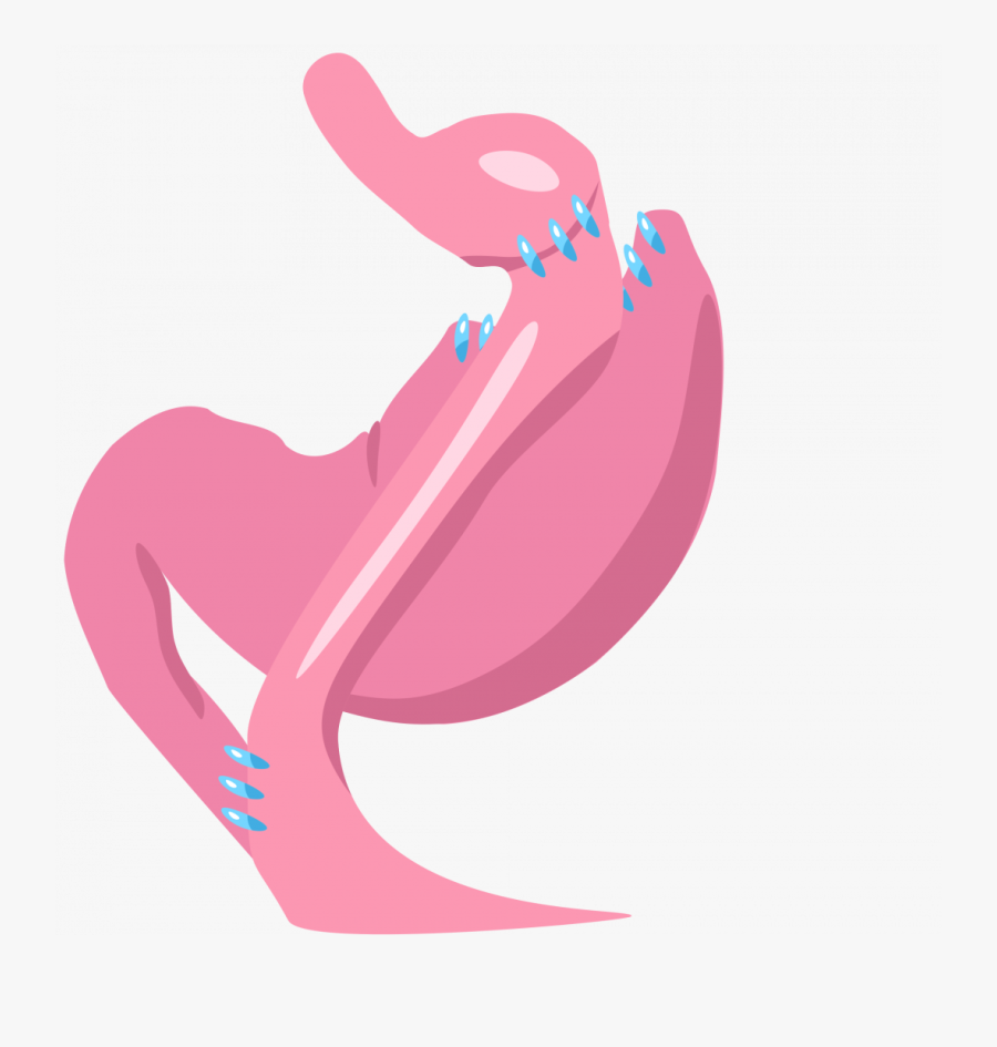 Gastric Bypass, Transparent Clipart