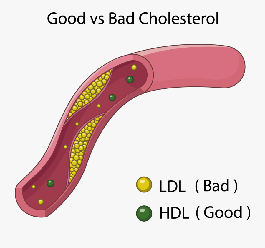 Good Bad Cholesterol, Transparent Clipart