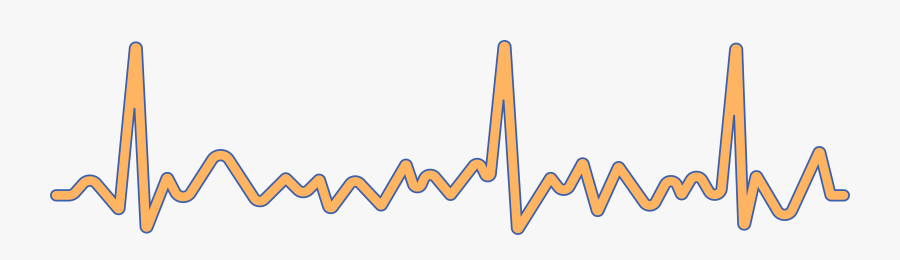 Atrial Fibrillation Clipart, Transparent Clipart