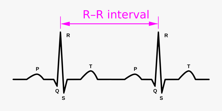 Ecg, Transparent Clipart