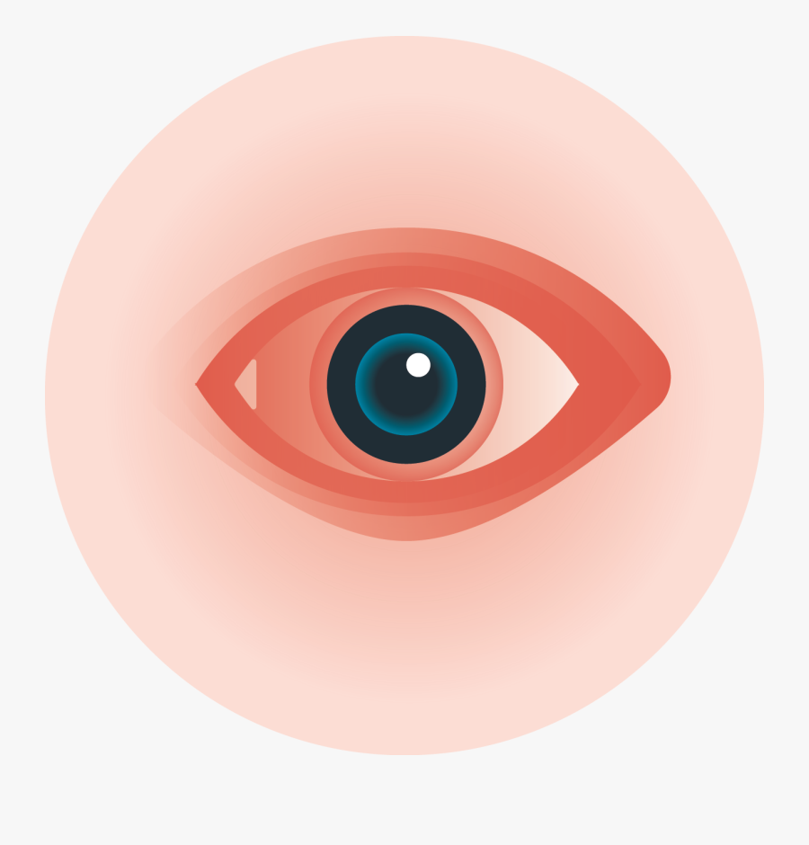 Wheel Art,ophthalmology - Eye Irritation Clipart, Transparent Clipart