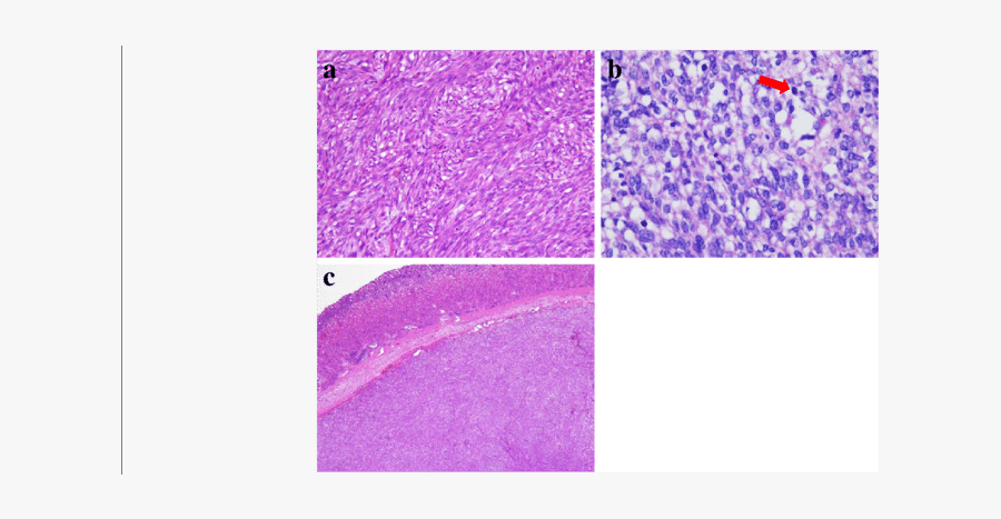 Clip Art A The Microscopic Findings - Art, Transparent Clipart