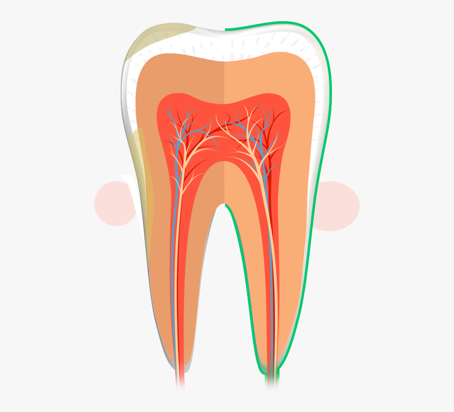 Periodontal Png, Transparent Clipart