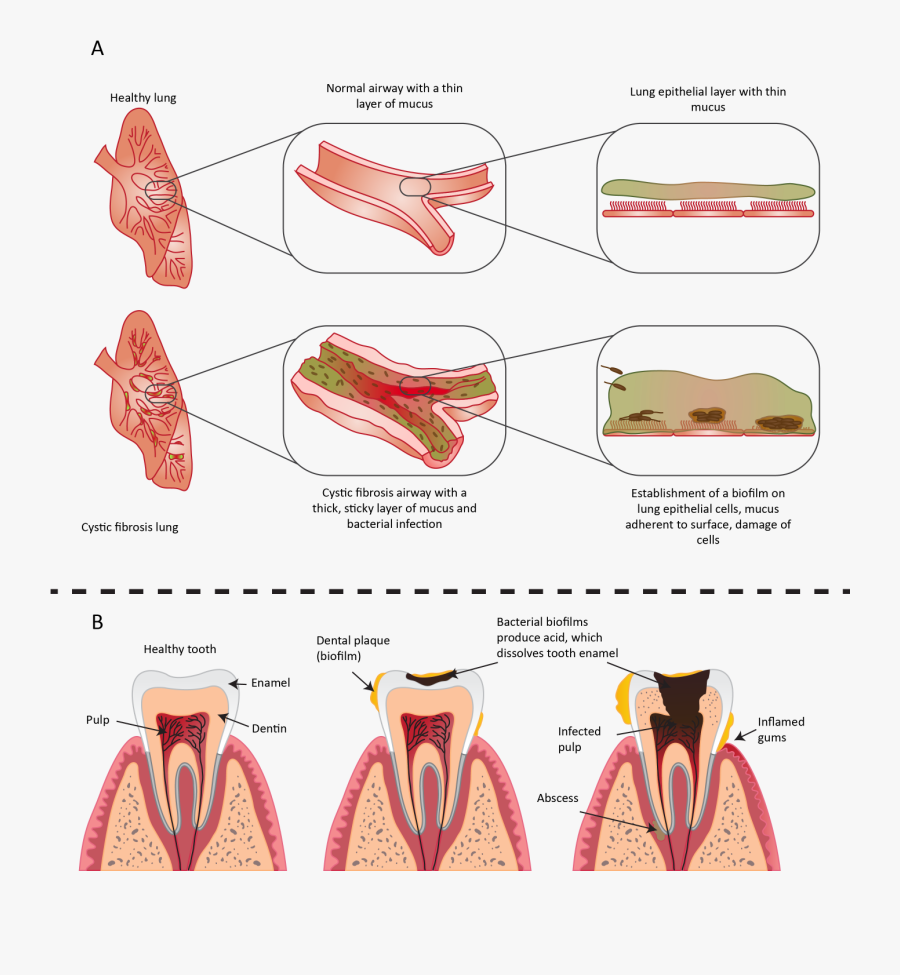 Ciclo Infeccioso Del Biofilm, Transparent Clipart