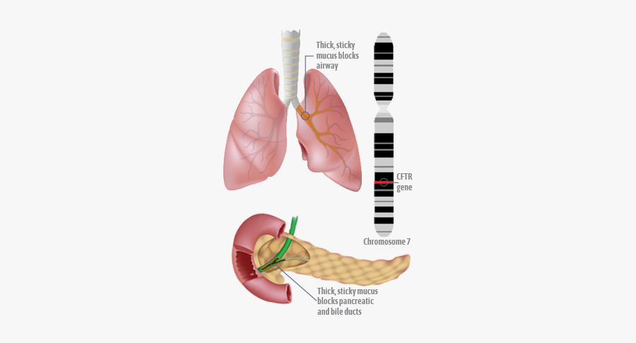 Thick Phlegm In Chest, Transparent Clipart