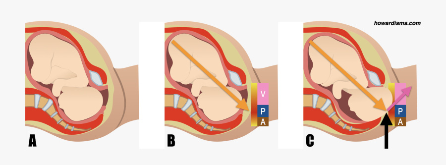 In The Illustration Above, We See In A A Baby Just, Transparent Clipart