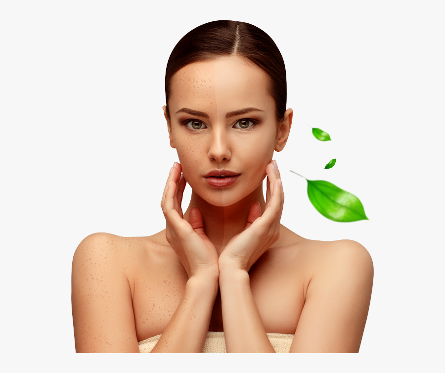 Skin Clipart Sun Damage - Girl, Transparent Clipart