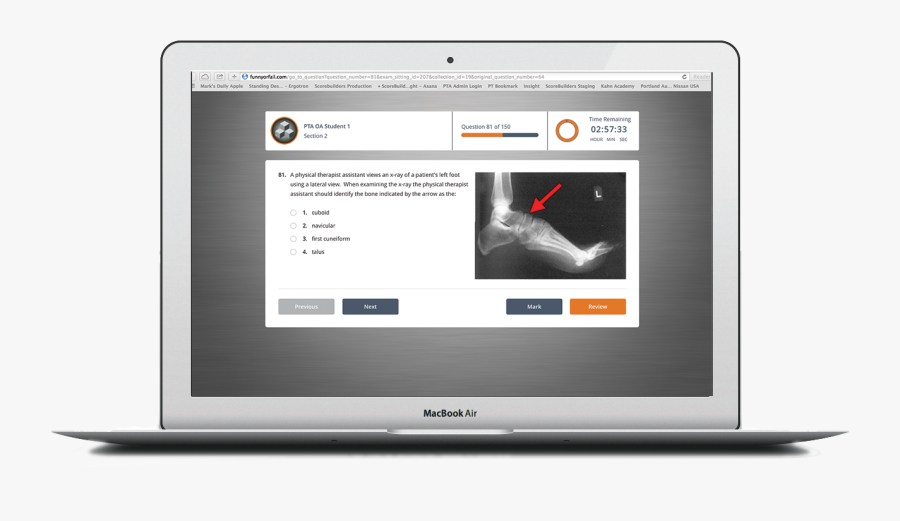About Oa Pta Sample Examinations - Led-backlit Lcd Display, Transparent Clipart