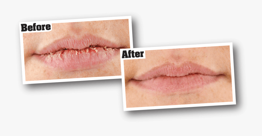 Repair Balm O Keeffe - O Keefe Lip Repair, Transparent Clipart