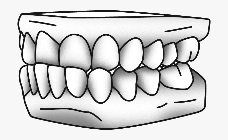 Denture Drawing At Getdrawings, Transparent Clipart