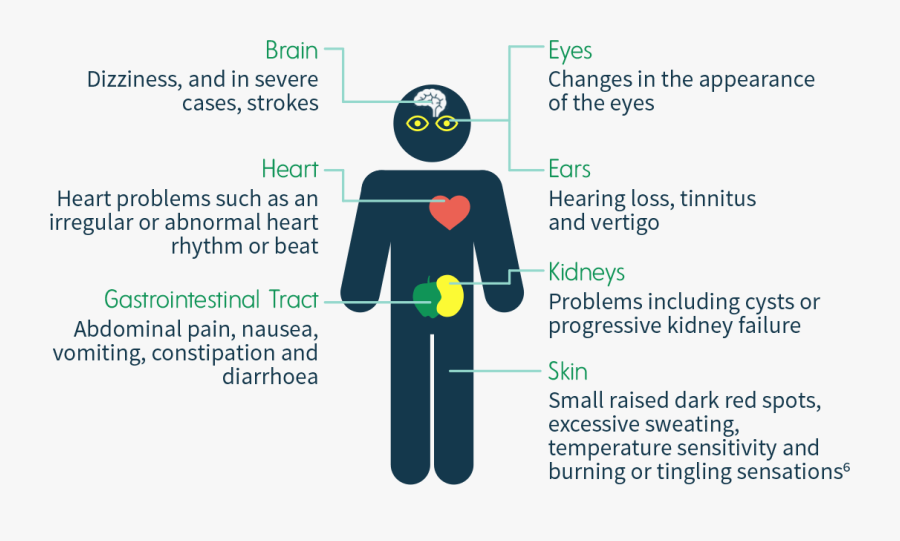Disease Clipart Symptom - Fabry Disease Signs, Transparent Clipart