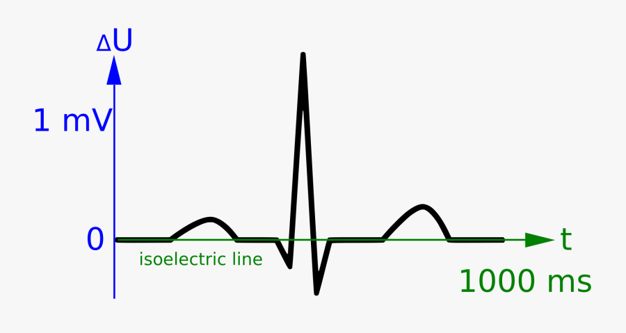 Picture Free Library File Curve Scales Wikimedia Commons - Ekg, Transparent Clipart