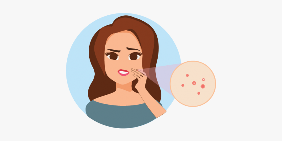 Acne-treatment - Illustration, Transparent Clipart