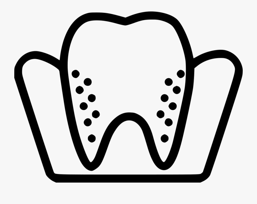 Rotten Molar - Dentistry, Transparent Clipart