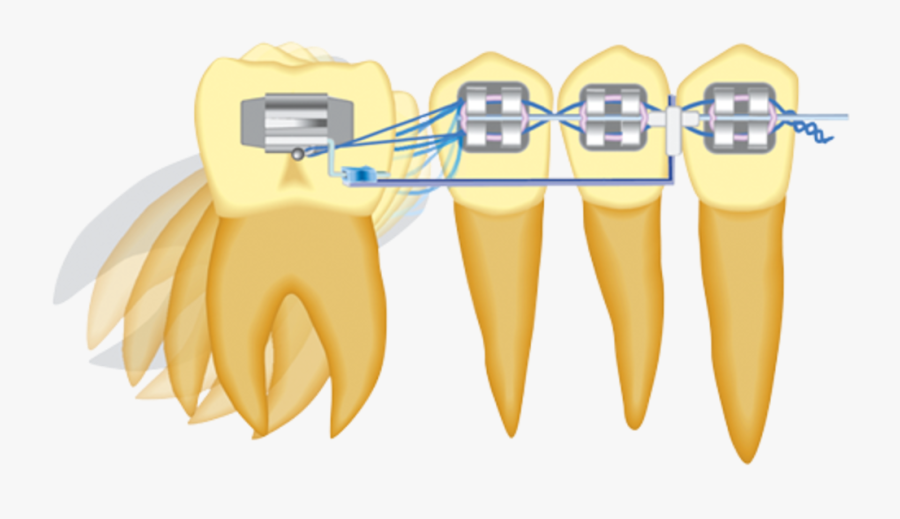 Clip Art, Transparent Clipart