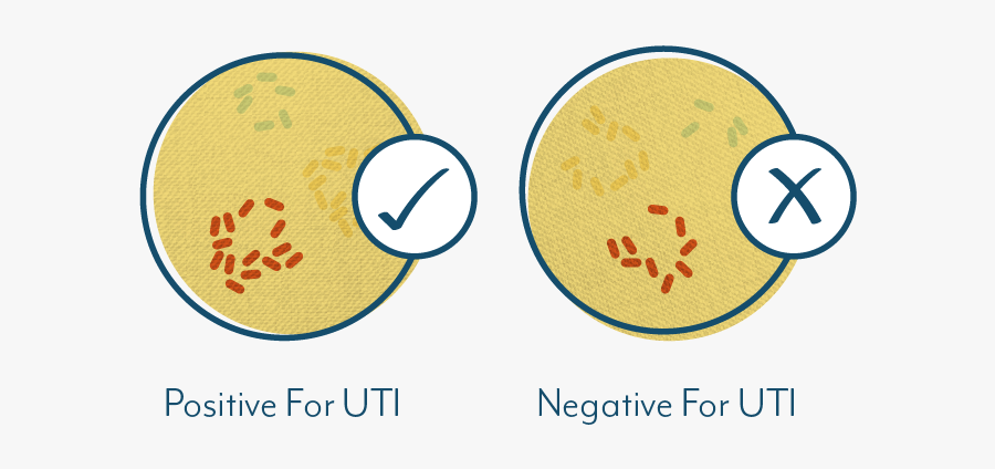 Why Your Test May - Uti Urine Culture, Transparent Clipart