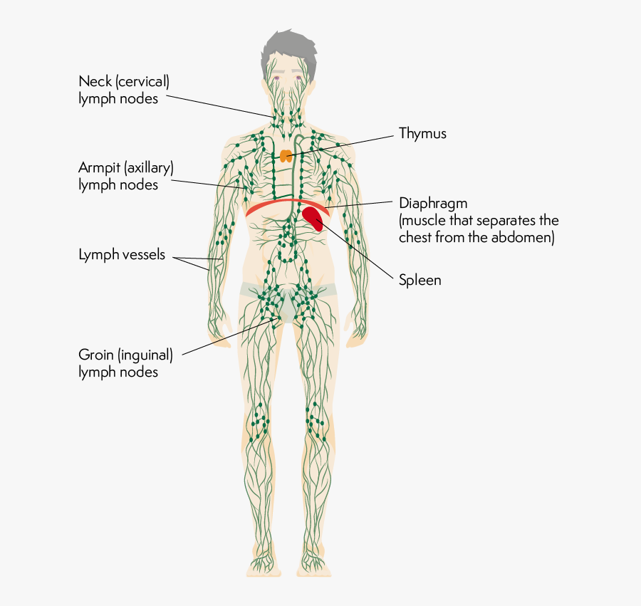 Clip Art Lymphoma Action Biopsy Diagram - Lymphatic System, Transparent Clipart