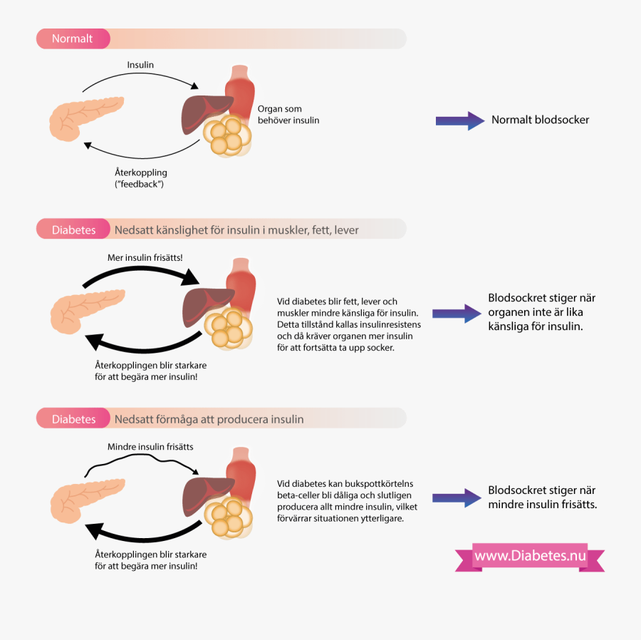 All About Type Causes, Transparent Clipart