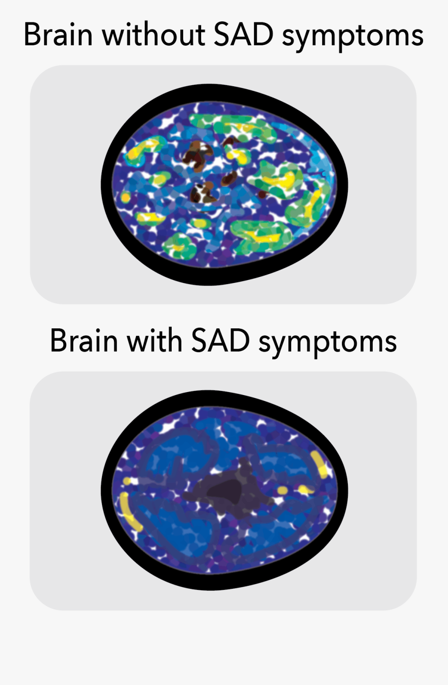 103119 Hs Seasonal Affective R Whelan - Circle, Transparent Clipart