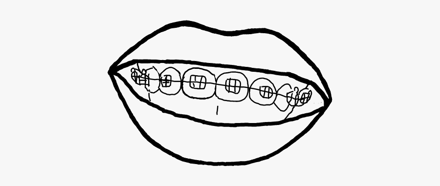 #brackets #sonrisa #dibujo #blancoynegro - Sketch, Transparent Clipart