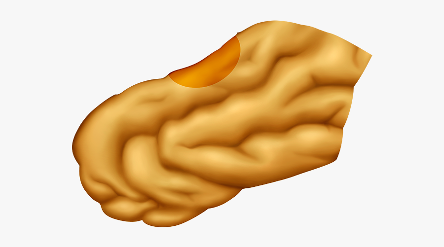 Temporal Lobe Separated From Brain, Transparent Clipart