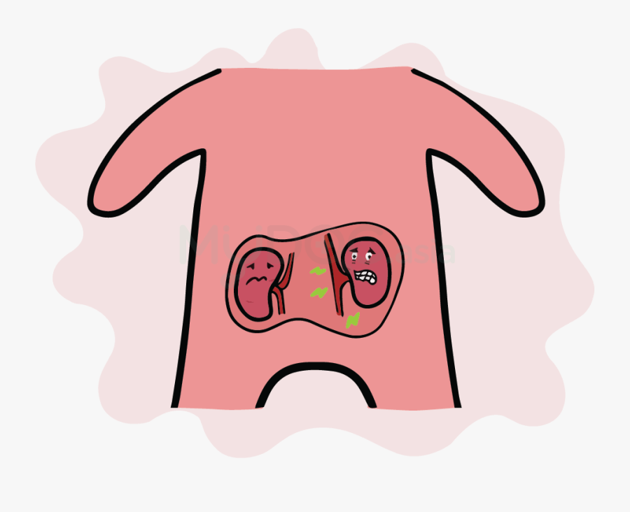 The Nightmares Following Diabetes, Transparent Clipart