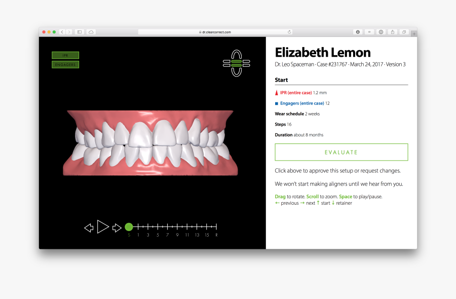 Screen Shot 2017 06 14 At - Clearcorrect Treatment Setup, Transparent Clipart
