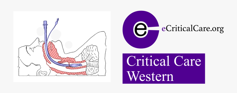 Critical Care Western Extubation - Extubation Clipart, Transparent Clipart