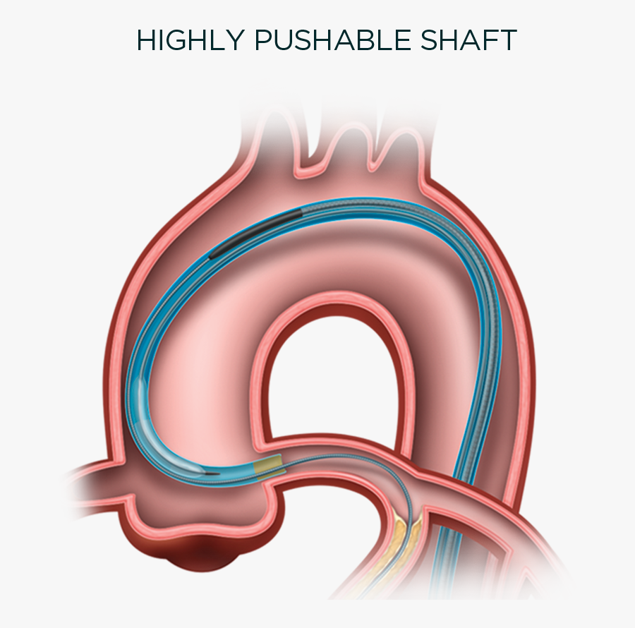 Imds Trapit, Transparent Clipart