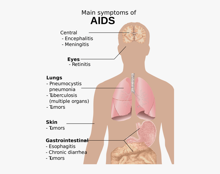 Main Symptoms Of Aids, Transparent Clipart