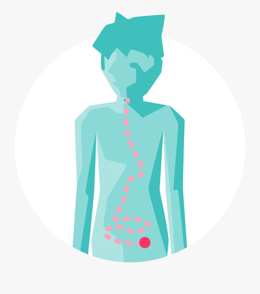 Inflammatory Bowel Disease - Illustration, Transparent Clipart
