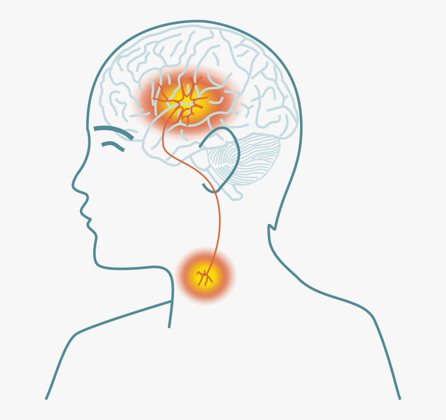 Cough Clipart Dysphagia - Stroke Disease Transparent Background, Transparent Clipart