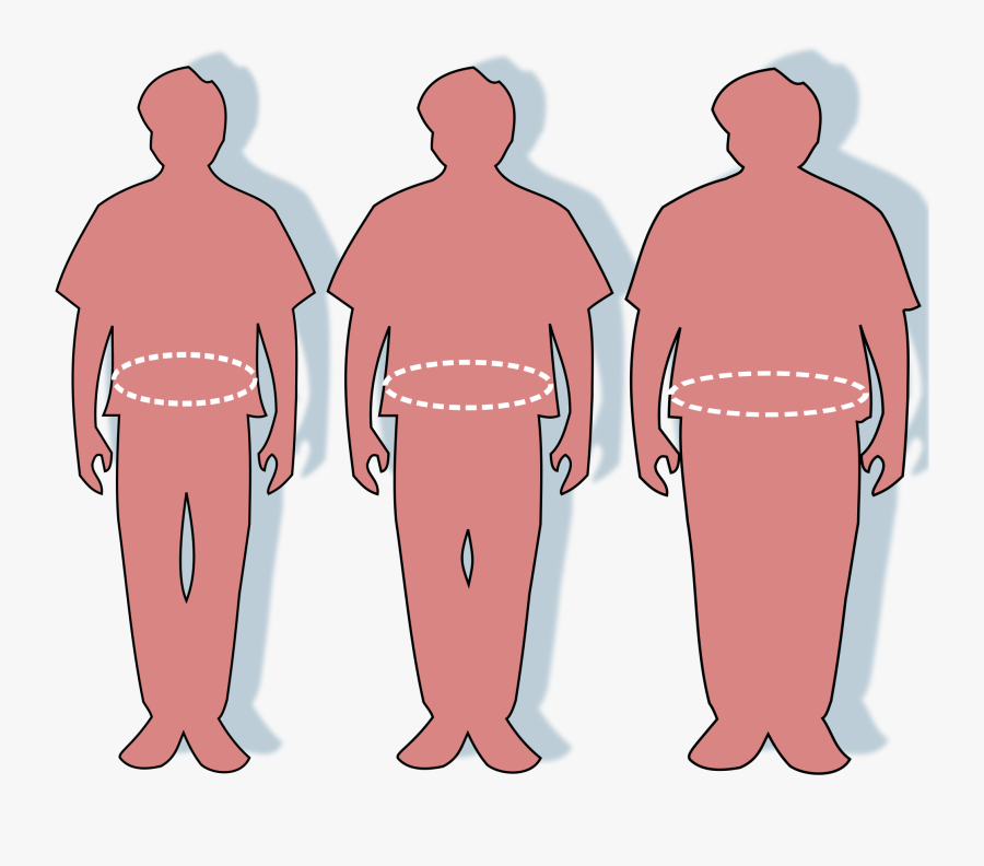 Obesity - Dharmasthala Nature Cure Price, Transparent Clipart