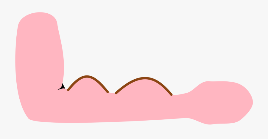 Pink,heart,cimino Fistula, Transparent Clipart