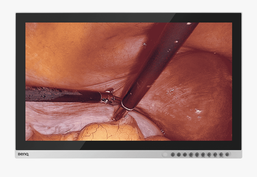 Picture Frame, Transparent Clipart