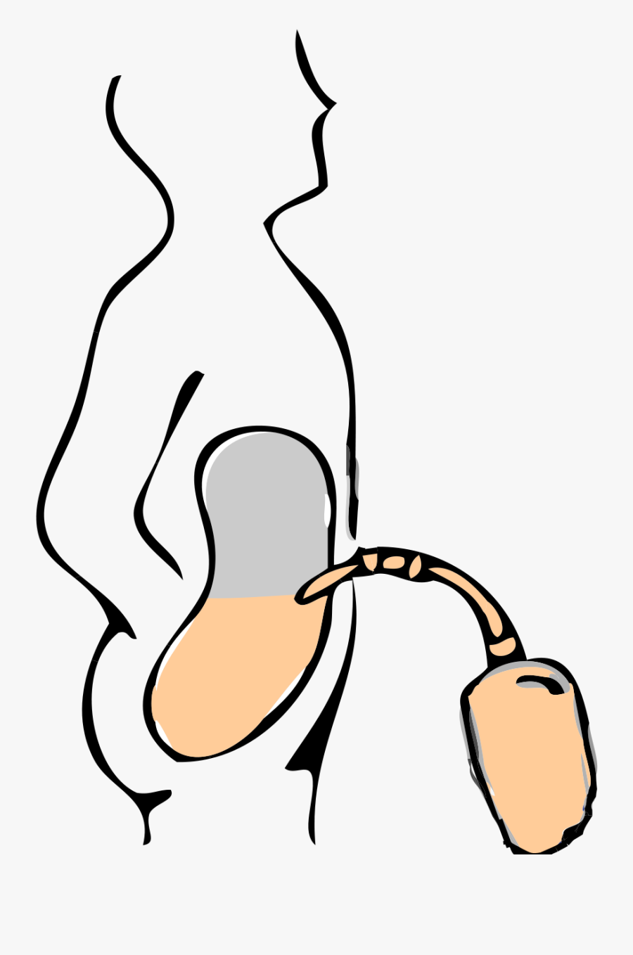 Peritoneal Dialysis Png, Transparent Clipart