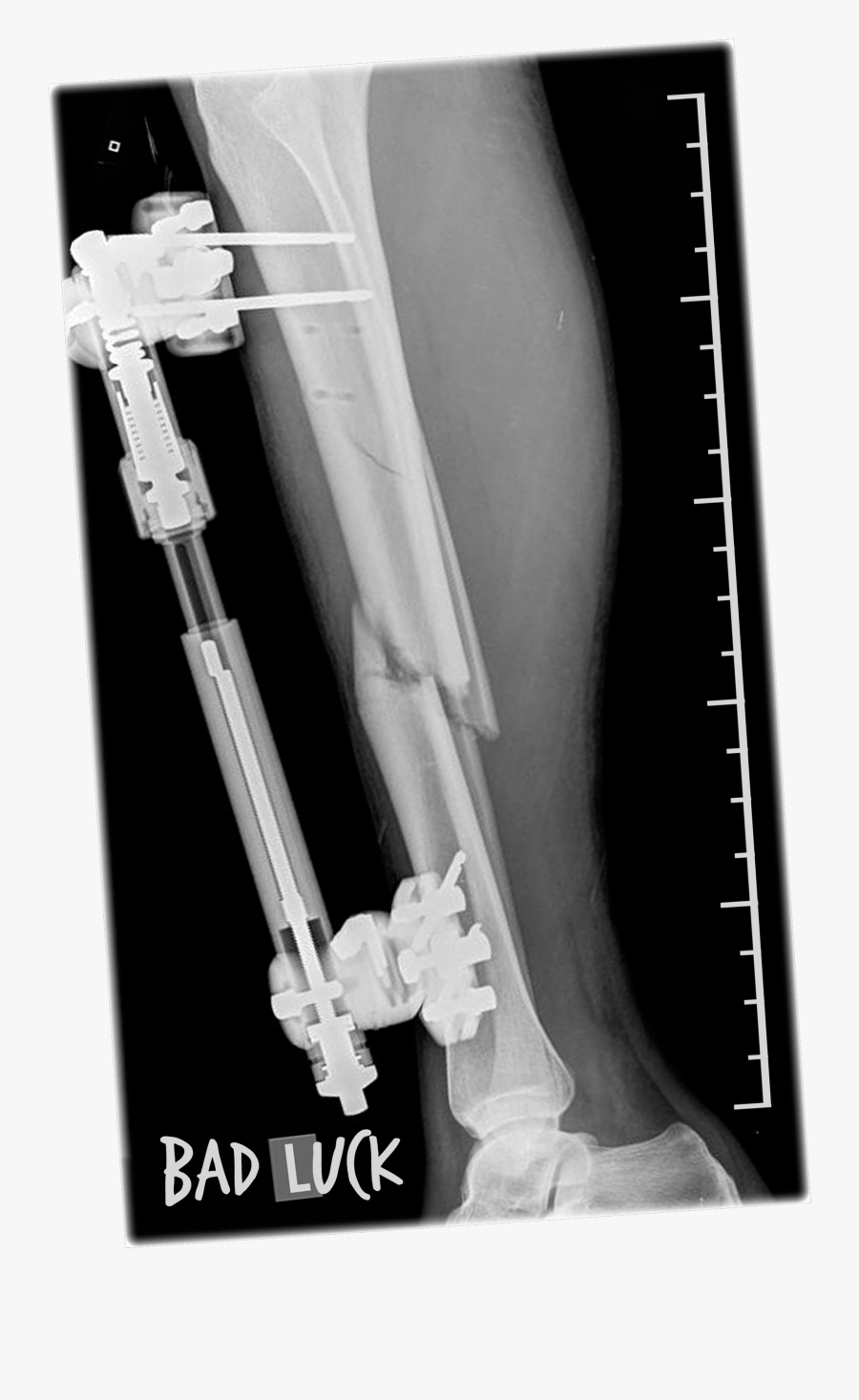 Break A Leg T Shirt Template Copy Small - X-ray, Transparent Clipart