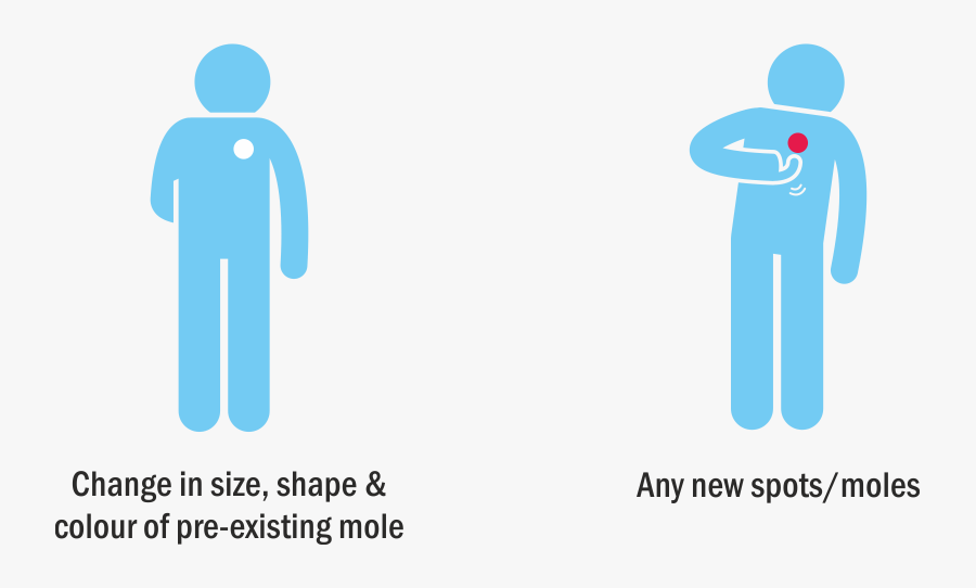 Skin Clipart Skin Cancer - Illustration, Transparent Clipart