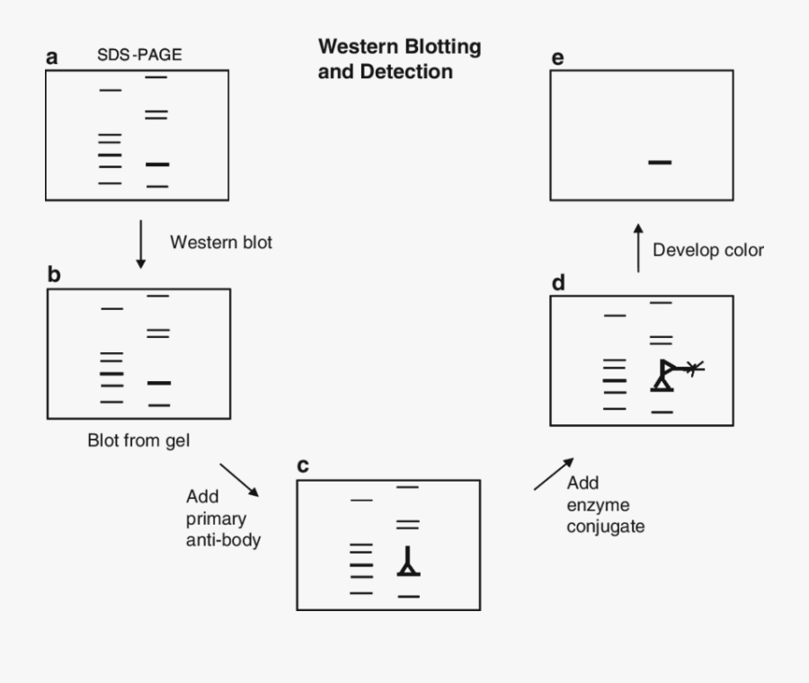 Western Blotting Technique Diagram, Transparent Clipart