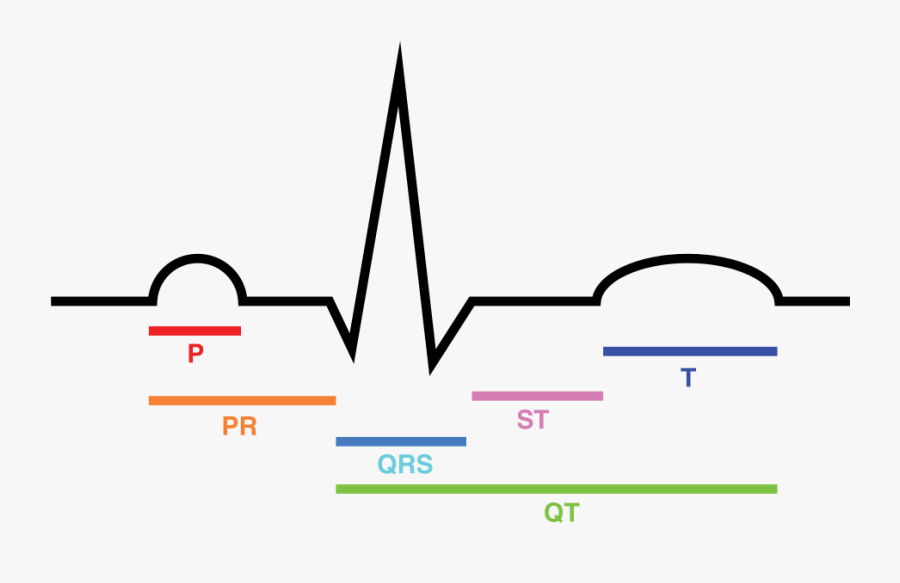 File - Ecg Intervals - Svg - Conduction System Of The - Ekg, Transparent Clipart