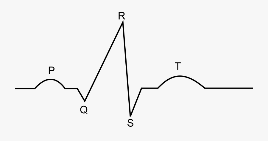 File Diagram Svg Wikimedia - نمودار Ecg, Transparent Clipart