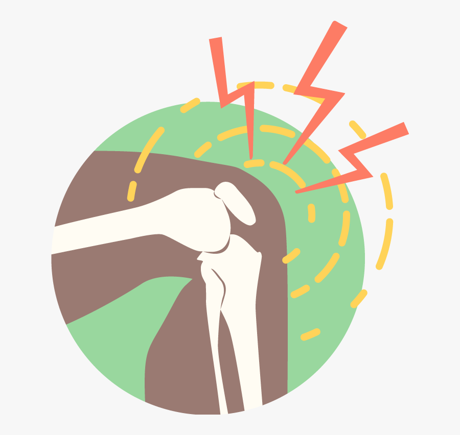 Hurt Clipart Knee Cap, Transparent Clipart