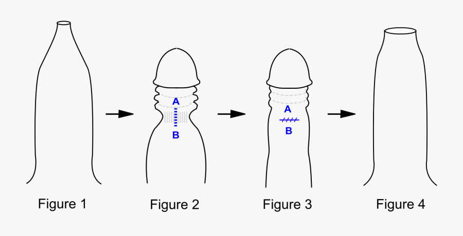 Mipa Zang Tih Len Dan, Transparent Clipart